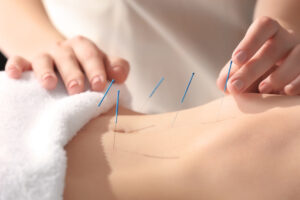 Is acupuncture scientifically proven for fertility