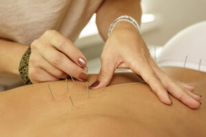 Where can I find a reliable acupuncture fertility specialist in Whittier