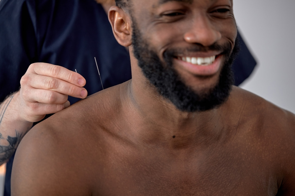 Where do acupuncture needles go for male fertility