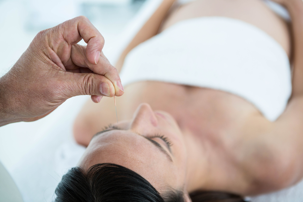 Does acupuncture improve IVF success rates?