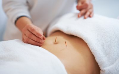 Acupuncture as a Tool for Addressing Ovulatory Disorders