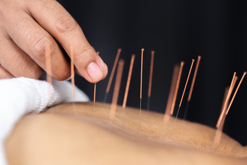 Where in Chino Hills can I schedule targeted acupuncture for fertility